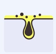 피부 단면 — 노란 오일 막이 모공 속까지 덮고, 그 위에 검은 노폐물 점들