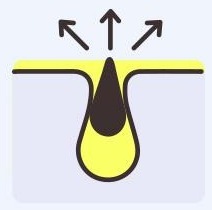 피부 단면 — 노란 오일에 싸인 검은 노폐물이 모공에서 위로 빠져나간다(위쪽 화살표 셋)